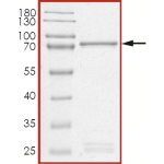 MET (D1213H), Active